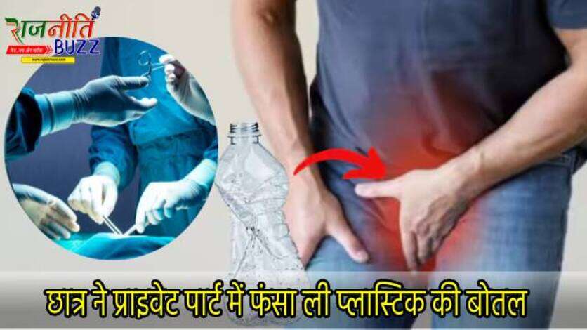 इंजीनियरिंग के छात्र ने Private Part में फंसा ली बोतल! पोर्न देखने के बाद किया खतरनाक एक्सपेरिमेंट, फिर डॅाक्टरों ने…